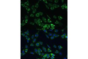 Immunofluorescence analysis of C6 cells using USP46 Polyclonal Antibody (ABIN7271165) at dilution of 1:100 (40x lens). (USP46 Antikörper)