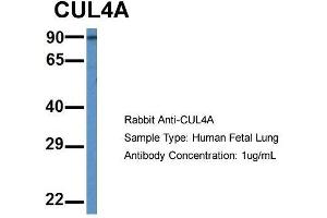 Host: Rabbit  Target Name: CUL4A  Sample Tissue: Human Fetal Lung  Antibody Dilution: 1. (Cullin 4A Antikörper  (Middle Region))