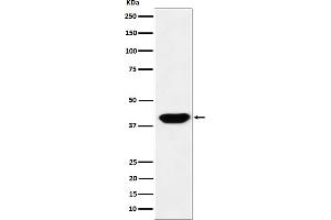 Western blot analysis of Islet1 expression in HeLa cell lysate.