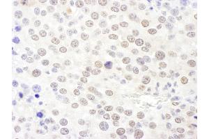 anti-NHP2 Non-Histone Chromosome Protein 2-Like 1 (NHP2L1) (AA 71-121) antibody