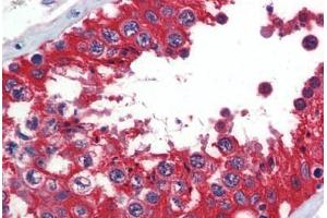Human Testis (formalin-fixed, paraffin-embedded) stained with  antibody ABIN462273 followed by biotinylated secondary antibody, alkaline phosphatase-streptavidin and chromogen. (Glucose-6-Phosphate Dehydrogenase Antikörper  (AA 35-506))