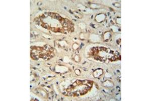 Immunohistochemistry (Paraffin-embedded Sections) (IHC (p)) image for anti-Protein Phosphatase, Mg2+/Mn2+ Dependent, 1L (PPM1L) (AA 215-244), (C-Term) antibody (ABIN954320)