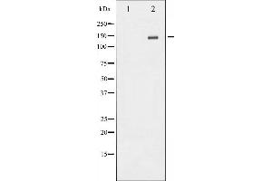 Western blot analysis of NMDAR2B phosphorylation expression in TNF treated Jurkat whole cell lysates,The lane on the left is treated with the antigen-specific peptide. (GRIN2B Antikörper  (pTyr1336))