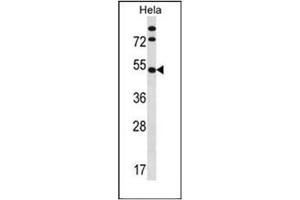 Western blot analysis of IP6K1 Antibody (N-term) in Hela cell line lysates (35ug/lane).