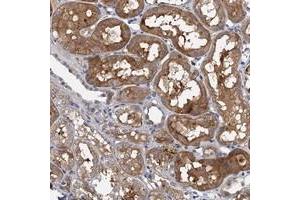 Immunohistochemical staining of human kidney with TPCN1 polyclonal antibody  shows moderate cytoplasmic positivity in cells in renal tubules at 1:20-1:50 dilution.