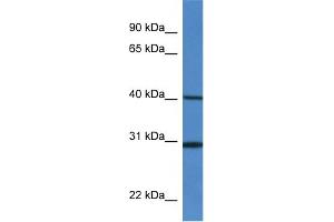 WB Suggested Anti-H13 Antibody   Titration: 1. (H13 Antikörper  (Middle Region))