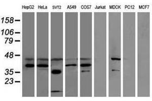 Image no. 2 for anti-Sulfotransferase Family, Cytosolic, 1C, Member 2 (SULT1C2) antibody (ABIN1501234) (SULT1C2 Antikörper)