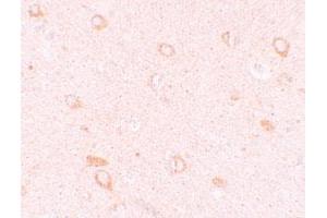 Immunohistochemical staining of human brain cells with CIITA polyclonal antibody  at 10 ug/mL. (CIITA Antikörper  (N-Term))