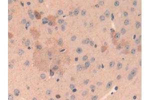 IHC-P analysis of Mouse Cerebrum Tissue, with DAB staining. (Cathepsin L Antikörper  (AA 18-113))
