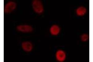 ABIN6274468 staining 293 cells by IF/ICC. (ISL2 Antikörper  (Internal Region))
