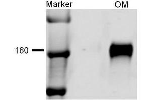 Western blot analysis of Rat kidney tissue lysates showing detection of NKCC2 protein using Rabbit Anti-NKCC2 Polyclonal Antibody . (SLC12A1 Antikörper  (AA 33-55) (Atto 390))