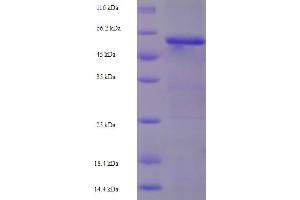 SDS-PAGE (SDS) image for Keratin 17 (KRT17) (AA 1-441), (full length) protein (His-SUMO Tag) (ABIN5709827)