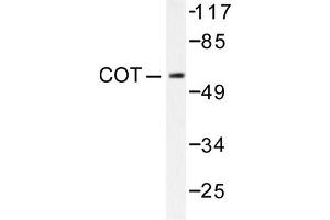 Image no. 1 for anti-Mitogen-Activated Protein Kinase Kinase Kinase 8 (MAP3K8) antibody (ABIN265369) (MAP3K8 Antikörper)