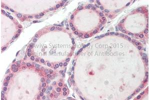 Rabbit Anti-TBC1D4 Antibody Catalog Number: ARP63880 Formalin Fixed Paraffin Embedded Tissue: Human Adult Thyroid  Observed Staining: Cytoplasm in hepatocytes Primary Antibody Concentration: 1:600 Secondary Antibody: Donkey anti-Rabbit-Cy3 Secondary Antibody Concentration: 1:200 Magnification: 20X Exposure Time: 0. (TBC1D4 Antikörper  (C-Term))