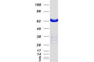 Western Blotting (WB) image for Lymphocyte Cytosolic Protein 2 (SH2 Domain Containing Leukocyte Protein of 76kDa) (LCP2) protein (Myc-DYKDDDDK Tag) (ABIN2724558)