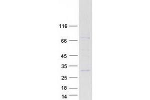 Validation with Western Blot (RS1 Protein (Myc-DYKDDDDK Tag))