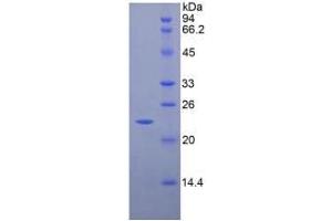 SDS-PAGE analysis of Rat CD8b Protein. (CD8B Protein)