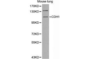 Western Blotting (WB) image for anti-Cadherin 1, Type 1, E-Cadherin (Epithelial) (CDH1) antibody (ABIN3023667) (E-cadherin Antikörper)