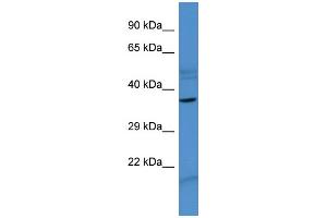 Host:  Rabbit  Target Name:  ZNF793  Sample Type:  MCF7 Whole cell lysates  Antibody Dilution:  1.