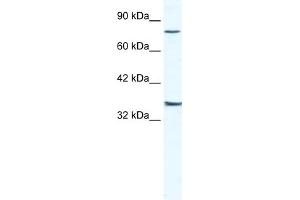 WB Suggested Anti-ZNF337 Antibody Titration:  2. (ZNF337 Antikörper  (Middle Region))