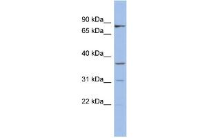 WB Suggested Anti-OLAH Antibody Titration: 0. (OLAH Antikörper  (N-Term))