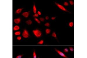 Immunofluorescence analysis of U2OS cells using KIF2C Polyclonal Antibody