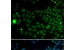 Immunofluorescence analysis of MCF-7 cells using SPDYA Polyclonal Antibody (SPDYA Antikörper)