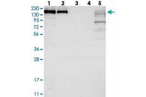 Western blot analysis of Lane 1: RT-4, Lane 2: U-251 MG, Lane 3: Human Plasma, Lane 4: Liver, Lane 5: Tonsil with SAMD9 polyclonal antibody  at 1:250-1:500 dilution. (SAMD9 Antikörper)