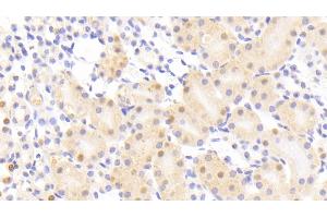 Detection of NUP88 in Mouse Kidney Tissue using Polyclonal Antibody to Nucleoporin 88 (NUP88) (NUP88 Antikörper  (AA 57-296))
