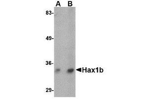 Western blot analysis of Hax1b in mouse brain tissue lysate with AP30393PU-N Hax1b antibody at (A) 1 and (B) 2 μg/ml. (HAX1 Antikörper  (N-Term))