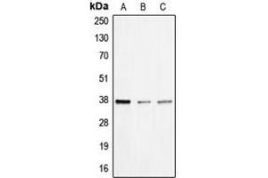 Western blot analysis of BNIP2 expression in HEK293T (A), mouse liver (B), rat liver (C) whole cell lysates. (BNIP2 Antikörper  (Center))