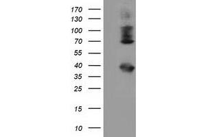 Western Blotting (WB) image for anti-Heat Shock Protein 70 (HSP70) antibody (ABIN1498749) (HSP70 Antikörper)