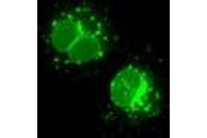 Anti-LEMD3 mouse monoclonal antibody (ABIN2453230) immunofluorescent staining of COS7 cells transiently transfected by pCMV6-ENTRY LEMD3 (RC212759). (LEMD3 Antikörper)