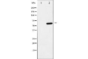 Western blot analysis of p62 Dok phosphorylation expression in K562 whole cell lysates,The lane on the left is treated with the antigen-specific peptide. (DOK1 Antikörper  (pTyr398))