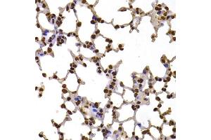Immunohistochemistry of paraffin-embedded mouse lung using FBXW7 antibody (ABIN5975397) at dilution of 1/100 (40x lens). (FBXW7 Antikörper)