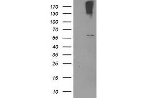 Western Blotting (WB) image for anti-Cytochrome P450, Family 2, Subfamily J, Polypeptide 2 (CYP2J2) antibody (ABIN1497734) (CYP2J2 Antikörper)