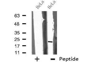 Western blot analysis of extracts from HeLa cells, using CHP antibody. (CHP Antikörper  (Internal Region))