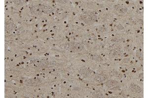 ABIN6255514 and ABIN6267208 at 1/100 staining Rat brain tissue by IHC-P. (MECP2 Antikörper  (pSer80))