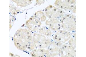 Immunohistochemistry of paraffin-embedded Human stomach using DNAL1 Polyclonal Antibody at dilution of 1:100 (40x lens). (DNAL1 Antikörper)