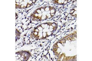 Immunohistochemistry (IHC) image for anti-Prostaglandin-Endoperoxide Synthase 2 (Prostaglandin G/H Synthase and Cyclooxygenase) (PTGS2) (AA 375-604) antibody (ABIN6146415)