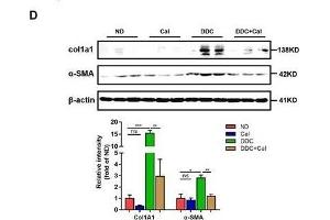 Calcipotriol alleviates DDC-induced liver injury and fibrosis. (COL1A1 Antikörper  (AA 100-200))