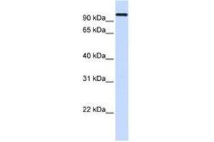 Image no. 1 for anti-Heat Shock 70kDa Protein 4 (HSPA4) (AA 684-733) antibody (ABIN6743405) (HSPA4 Antikörper  (AA 684-733))