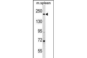 MYH7 Antibody (N-term) (ABIN1539139 and ABIN2849216) western blot analysis in mouse spleen tissue lysates (35 μg/lane). (MYH7 Antikörper  (N-Term))