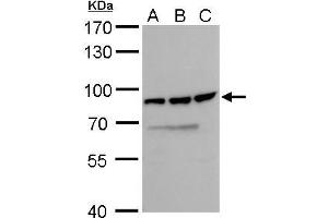 WB Image DDX18 antibody detects DDX18 protein by Western blot analysis. (DDX18 Antikörper  (Center))