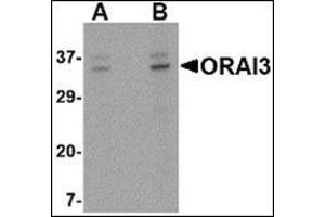 Western blot analysis of ORAI3 in A20 cell lysate with this product at (A) 2 and (B) 4 μg/ml. (ORAI3 Antikörper  (C-Term))