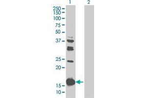 Western Blotting (WB) image for ASC 293T Cell Transient Overexpression Lysate(Denatured) (ABIN1336093)