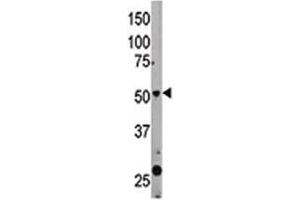 The Beclin 1 antibody used in western blot to detect BECN1 in mouse liver tissue lysate (Beclin 1 Antikörper  (AA 181-210))