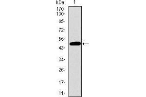 Western blot analysis using TP53BP1 mAb against human TP53BP1 recombinant protein. (TP53BP1 Antikörper  (AA 574-773))