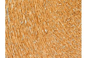 ABIN6264198 and ABIN6266655 at 1/100 staining Rat heart tissue by IHC-P. (PIAS3 Antikörper  (N-Term))