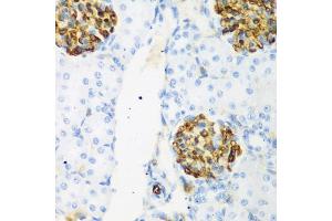 Immunohistochemistry of paraffin-embedded rat kidney using CSRNP1 antibody (ABIN5974288) at dilution of 1/200 (40x lens). (AXUD1 Antikörper)